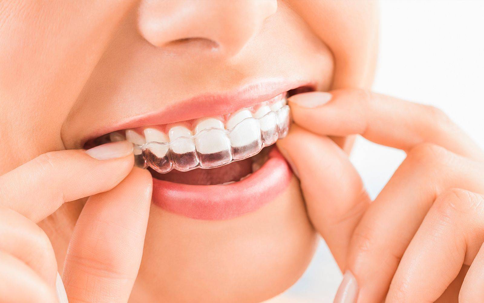 Harrison Dental Boise